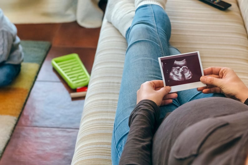 baby ultrasound